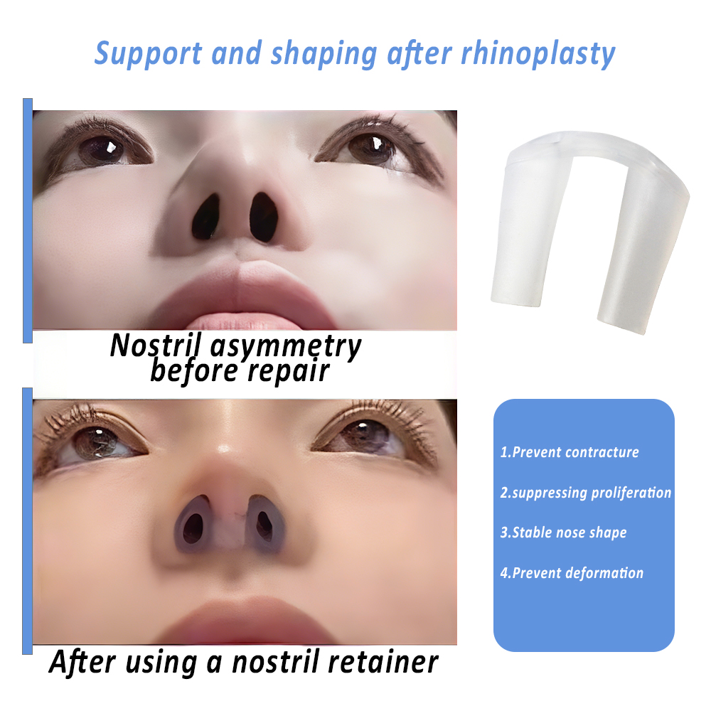 鼻整形術後用ノーズリテーナー、ソフトシリコン製鼻形成用ノーズ - Anti Snore Contour Pillow のレビューと価格